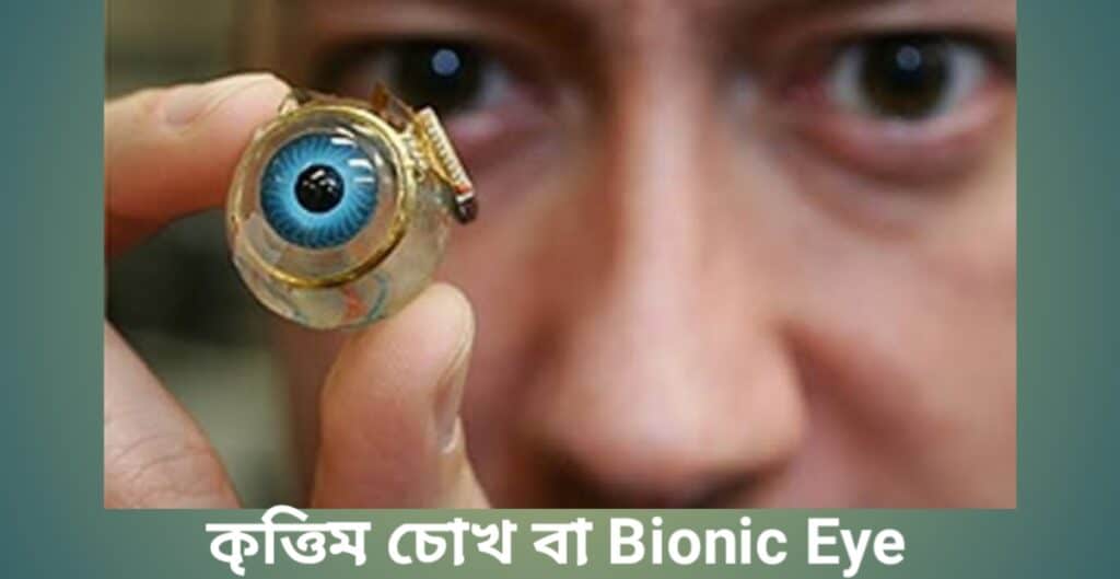 Bionic eye